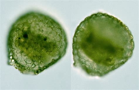 Protist Images: Difflugia