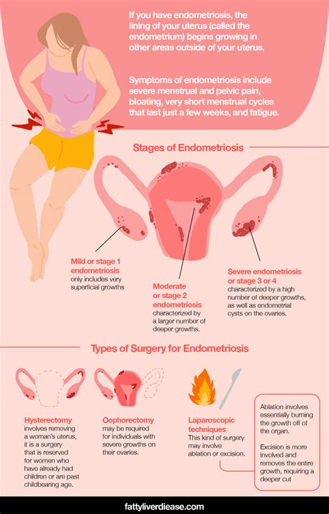 Endometriosis Surgery and How to Support Recovery - Fatty Liver Disease