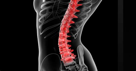 Lumbar Sympathetic Blocks and Neurolysis - Atlanta, GA - Spine Surgery