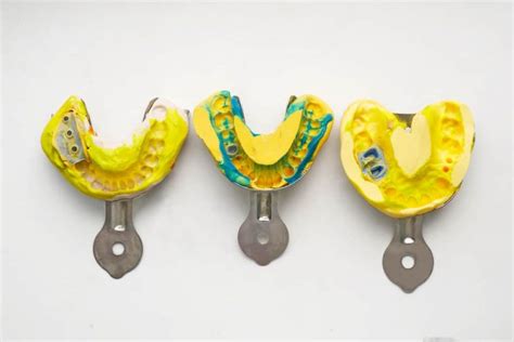 Comparing Types of Dental Impression Materials - STOMADENT