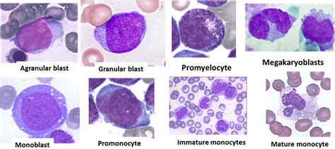 Promyelocyte