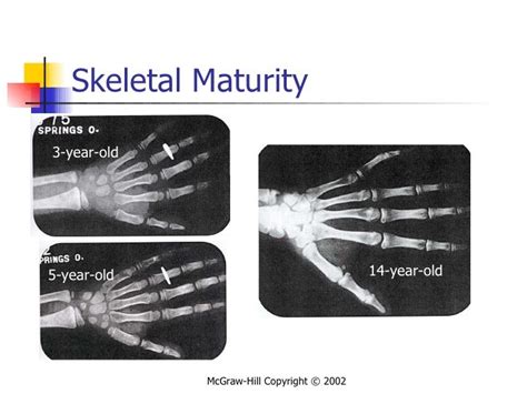 Measuring Growth & Bone Age