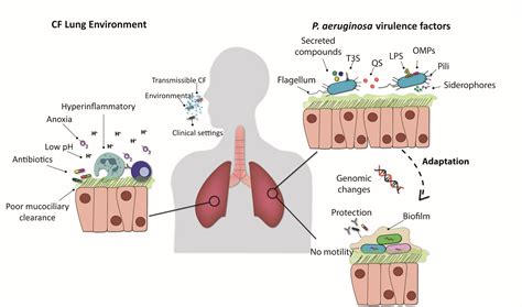 IJMS | Free Full-Text | Pseudomonas aeruginosa: An Audacious Pathogen ...