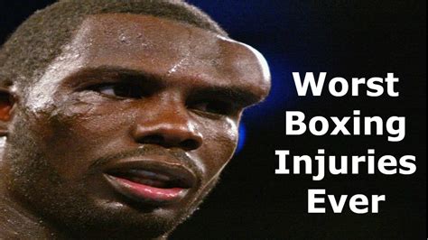 WORST Boxing injuries EVER - YouTube