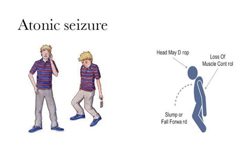 Atonic Seizure - MEDizzy