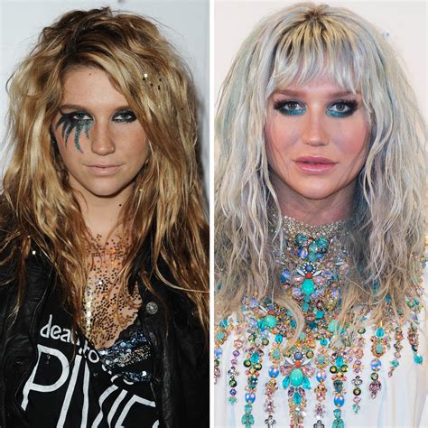 Kesha - MyrenPriscilla