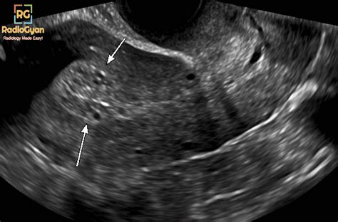 Classic Radiology Cases 3 | Spotters Set 57 | RadioGyan.com