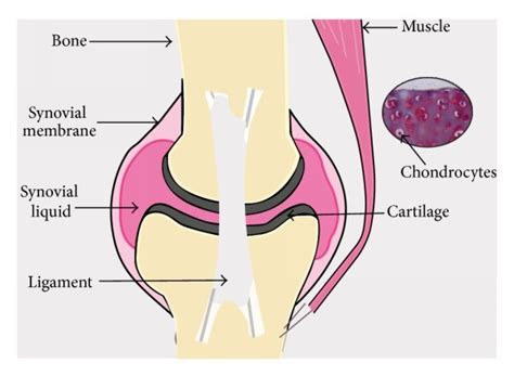 An overview of a typical joint structure. Hyaline cartilage, the most ...