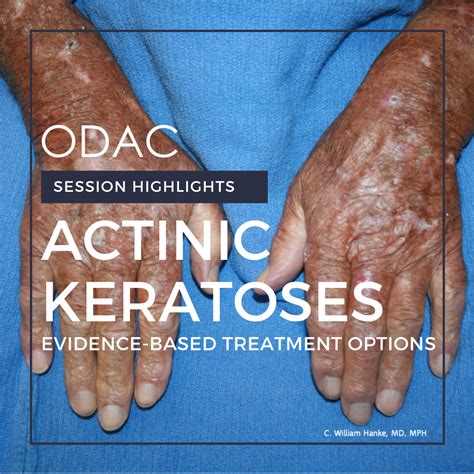 Actinic Keratoses: Evidence-Based Treatment Options - Next Steps in ...