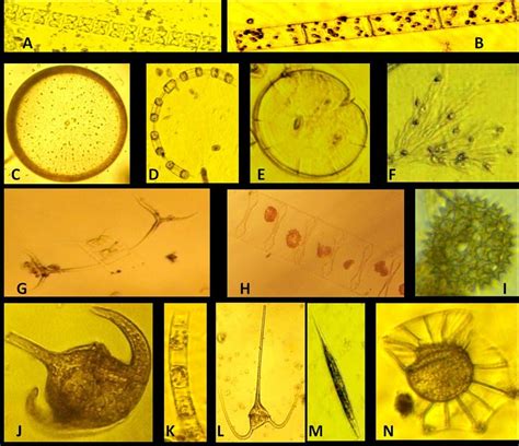 Under-microscope photographs of newly reported phytoplankton species ...