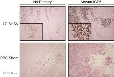 Anti-HSV1 + HSV2 ICP5 Major Capsid Protein antibody [3B6] (ab6508) | Abcam