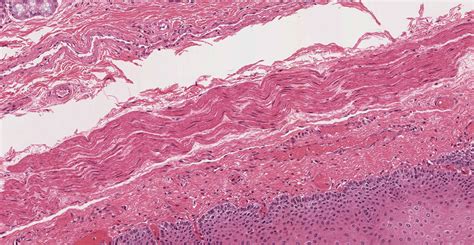 Pharynx, Esophagus, and Stomach | histology