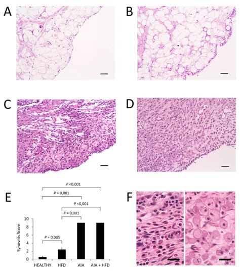 Histopathology of the synovial membrane. A-D, Representative sections ...