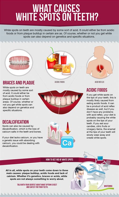 What Causes White Spots on Teeth?