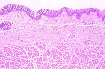 Larynx Histology - Larynx - histology slide