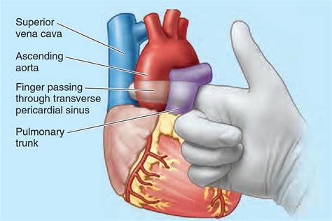 Anatomia - Surgical Significance of Transverse... | Facebook