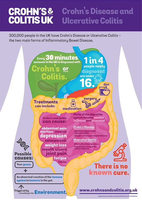 Ulcerative Colitis Symptoms