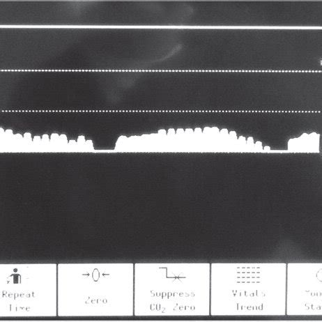 Capnograph trace during cardiac arrest with on-going CPR. The positive ...