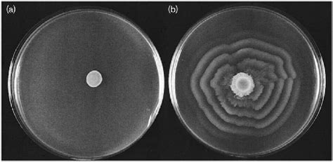 Proteus Mirabilis Swarming Motility