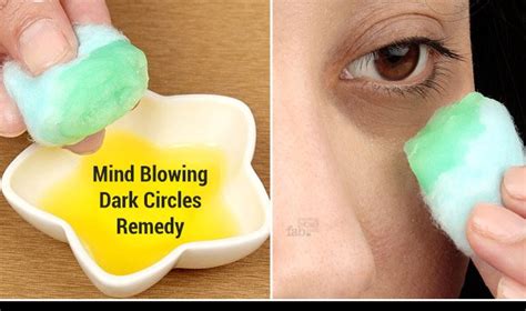 Home Remedies for Dark Circles under the Eyes - Page 2 of 3 | Top 10 ...