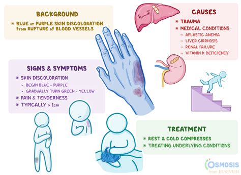 Ecchymosis: What Is It, Causes, Symptoms, and More | Osmosis