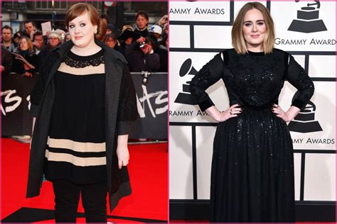 Adele’s Before and After Surgery Photos Show Proof of the Singer’s ...