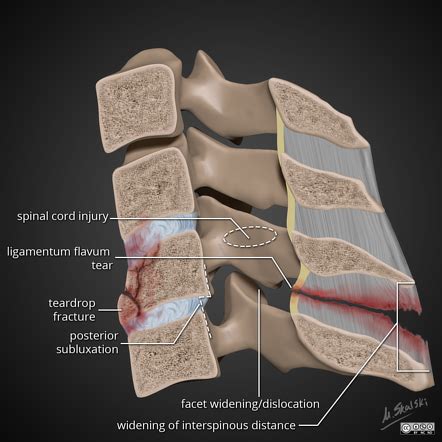 Playlist 'Diagnostic Imaging III-Spinal Trauma' by Dr. Sandra Norton