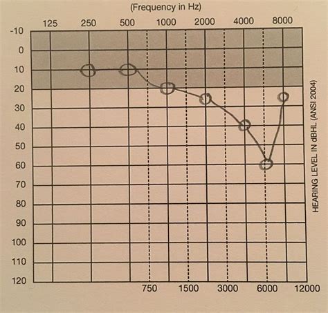 How to Read an Audiogram | Iowa Head and Neck Protocols