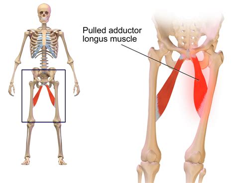 Diagram Of Groin Area Groin Area Anatomy Anatomy Drawing Diagram ...