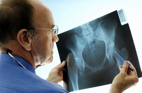 Orthopedic Surgeons: 7 Things You Need to Know | Penn Medicine