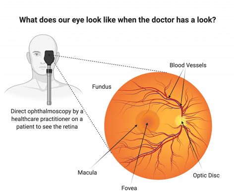 The retina and retinal pigment epithelium (RPE) | UCL Institute of ...