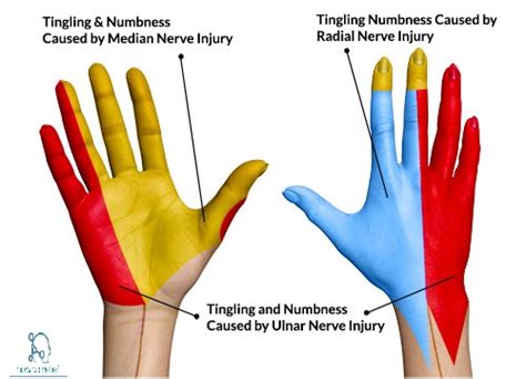 Ulnar nerve : Course, Motor, Sensory & Common Injuries » How To Relief