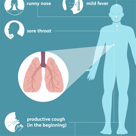 Bronchitis Symptoms, Signs, and Complications