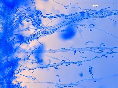 Fun With Microbiology (What's Buggin' You?): Trichosporon species