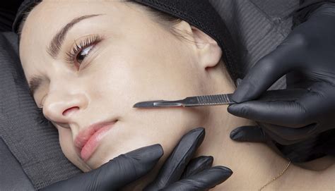 Dermaplaning | Is It The Right Treatment For You?