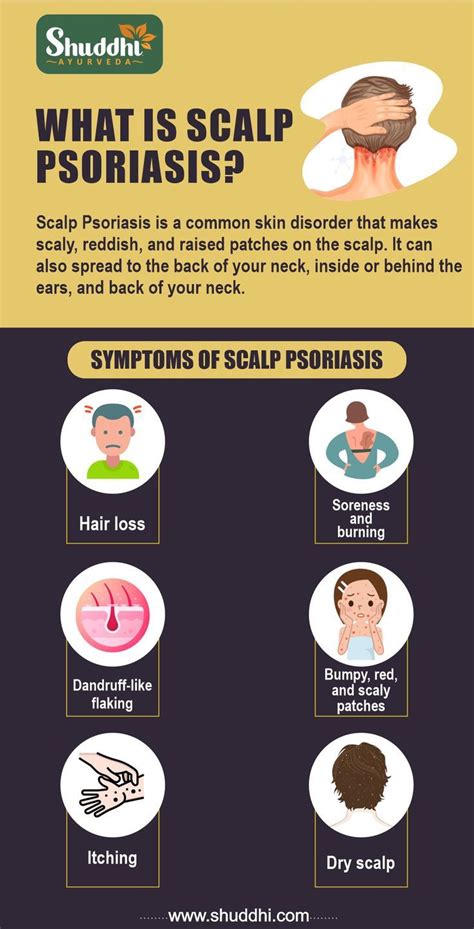 Get the precise understanding of scalp psoriasis treatment – Artofit