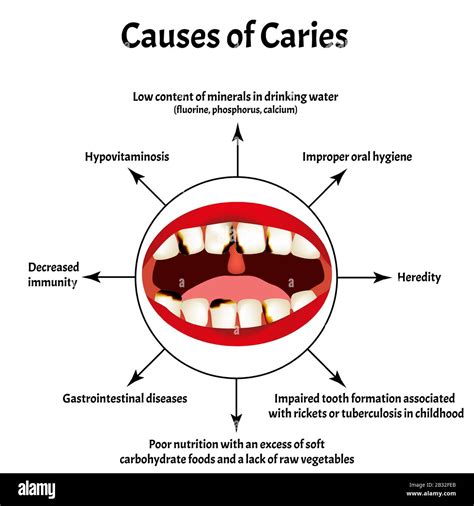 Top 96+ Wallpaper Picture Of Teeth In Mouth Excellent