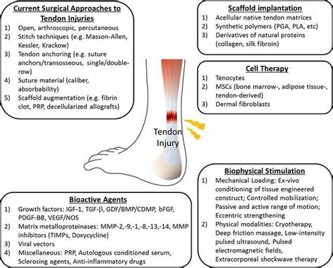 Tendon & Ligament Repair - Community and Side Projects - Sapien Medicine