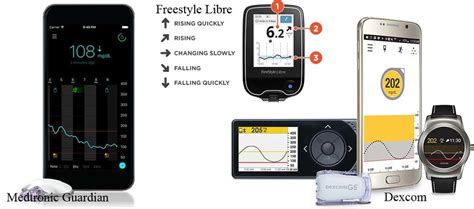 Glucose Sensors Make Diabetes Better For Me – Diabetes Daily