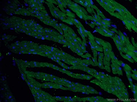 RYR2 antibody (19765-1-AP) | Proteintech