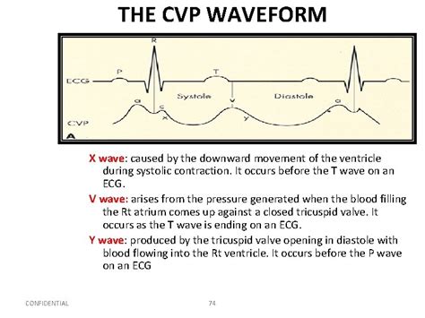 Hemodynamic Monitoring Atrerial Line CVP Line NSG 409