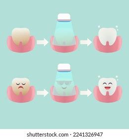 Cute Cartoon Teeth Characters Before After Stock Vector (Royalty Free ...