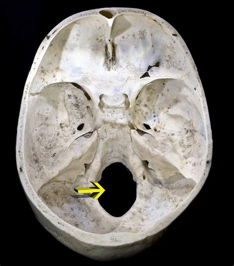 What is the structure and function of the foramen magnum? — Brain Stuff