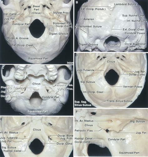 Occipital Groove