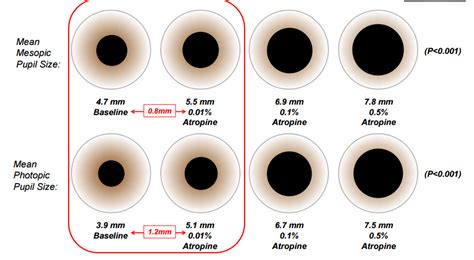 Pupil Size Chart Normal