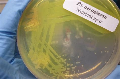 Pseudomonas aeruginosa culture