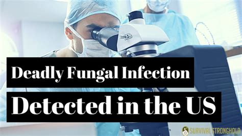 Survival News: Deadly Fungal Infection Detected in US – Survival Stronghold