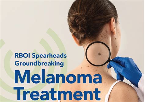 Goundbreaking Melanoma Treatment - Robert Boissoneault Oncology Institute