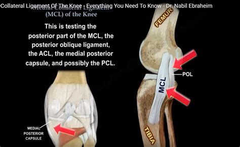 Medial Collateral Ligament Knee Injury