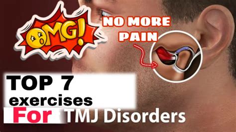 Tmj Exercises Stretches To Relieve Jaw Pain Ask Doctor Jo Youtube ...